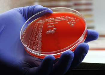 Can alternative methods be used in pharmaceutical microbiology testing?